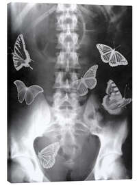 Tableau sur toile  Des papillons dans le ventre - PhotoStock-Israel